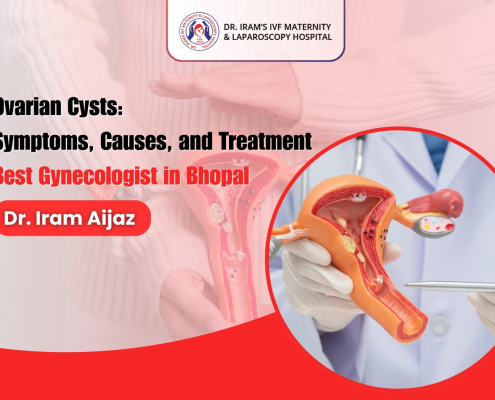 Ovarian cysts awareness banner featuring a gynecologist holding a female reproductive system model with text about symptoms, causes, treatment, and Dr. Iram Aijaz, Best Gynecologist in Bhopal.
